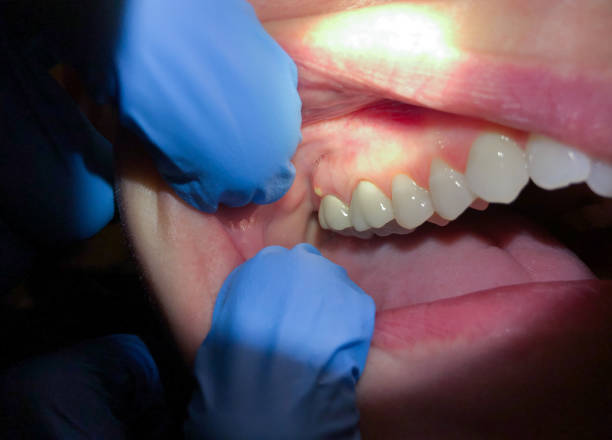 Best Weekend Emergency Dentist in Livingston, AL