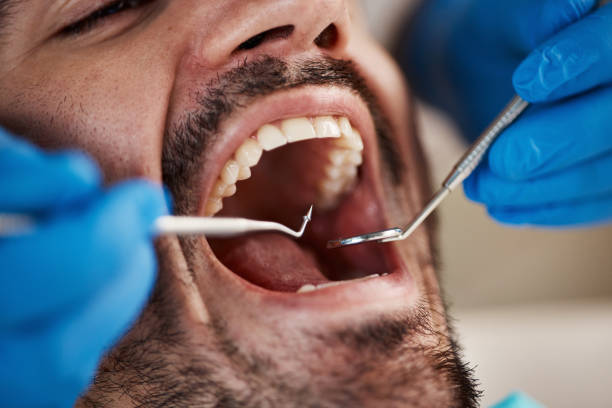 Best Emergency Dental Care for Trauma or Injury in Livingston, AL