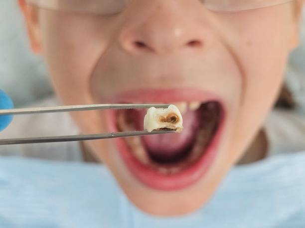 Best Emergency Orthodontic Repairs in Livingston, AL