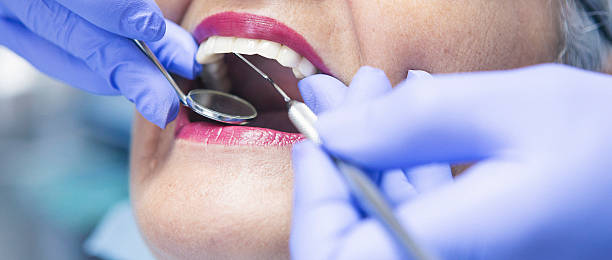 Best Emergency Tooth Extraction in Livingston, AL
